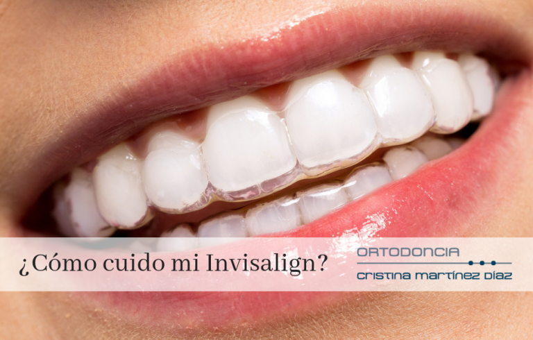 ¿Cómo cuido mi Invisalign?