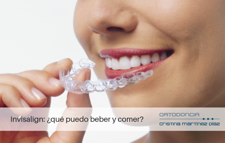 Invisalign: ¿qué puedo beber y comer?
