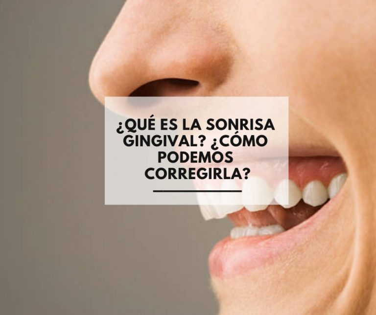 ¿Qué es la sonrisa gingival? ¿Cómo podemos corregirla?