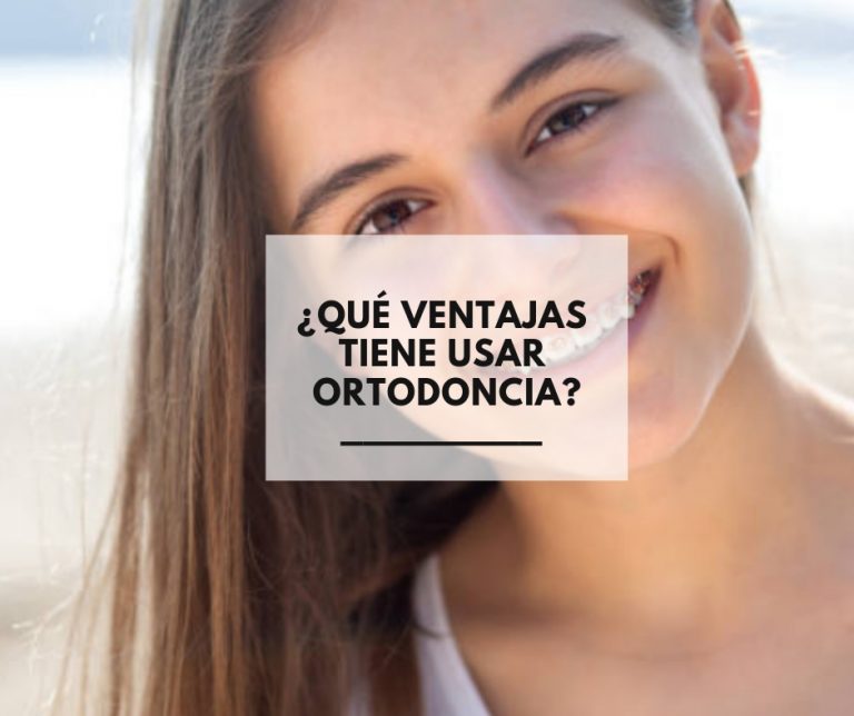 ¿Qué ventajas tiene usar ortodoncia?